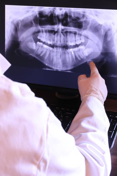 Best Emergency Tooth Extraction in Early, TX