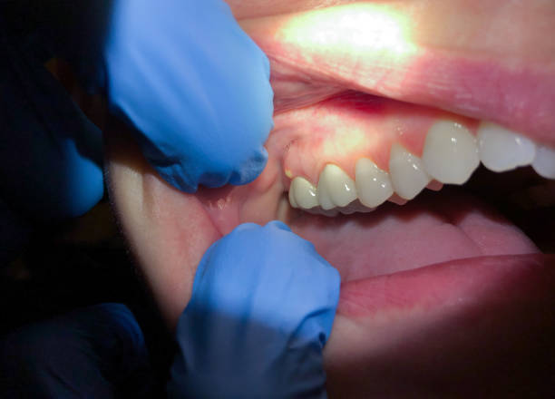 Best Pediatric Emergency Dentist in Early, TX