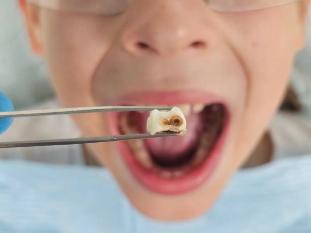 Best Pediatric Emergency Dentist in Early, TX